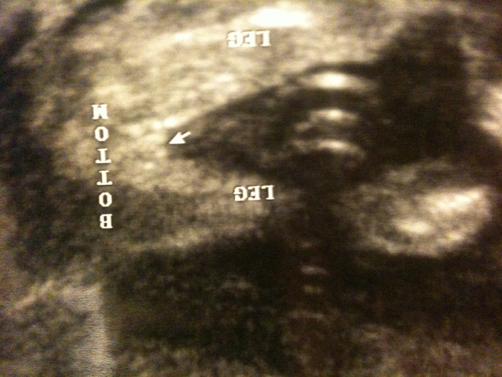 16 weeks said boy 20 weeks said girl (potty shots)