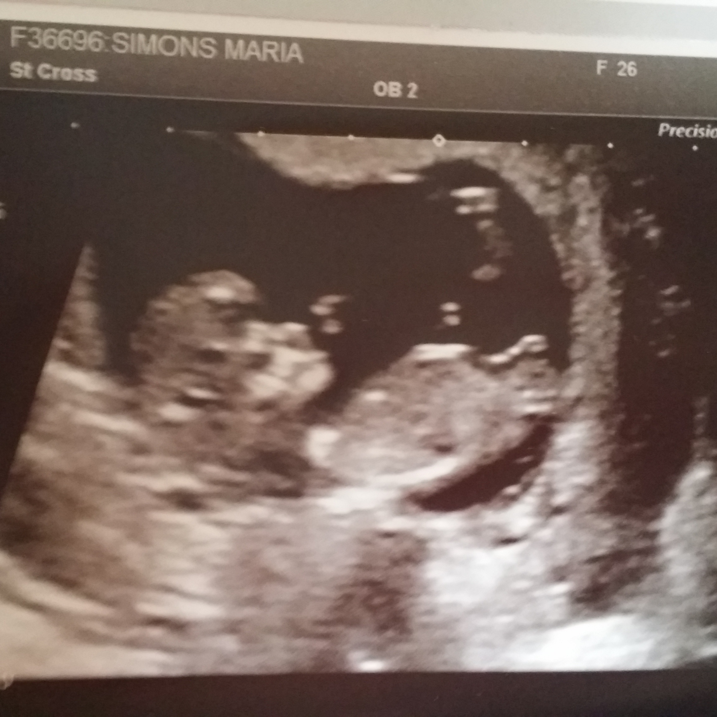 predictions on gender from 12 week scan