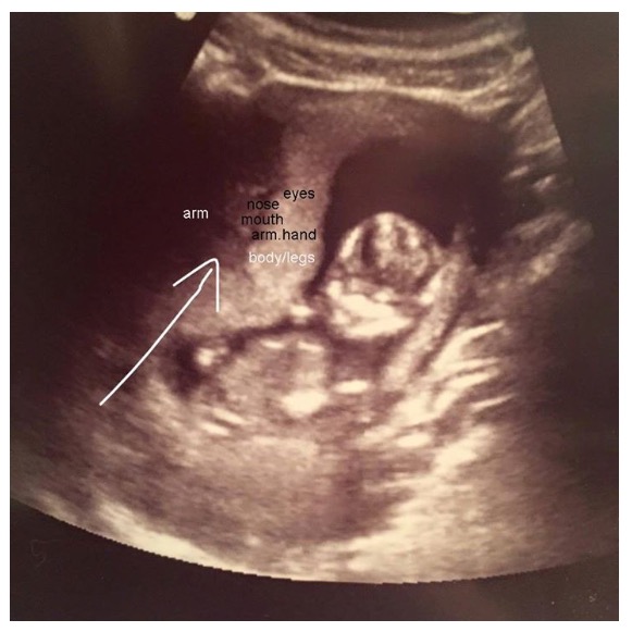 Any techs here? Could this be a hidden twin?