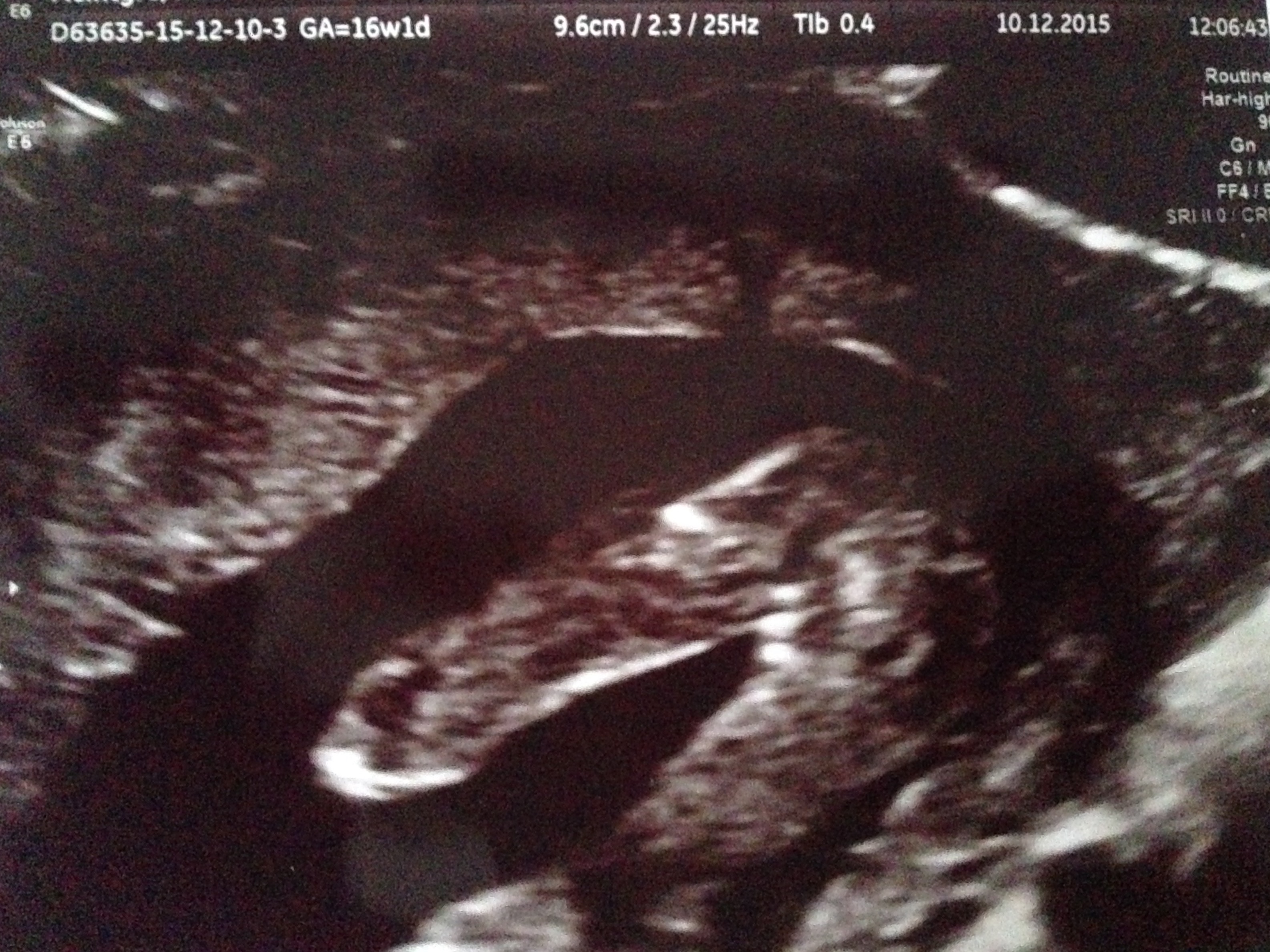 16 week potty shot lines not between the legs what is this???