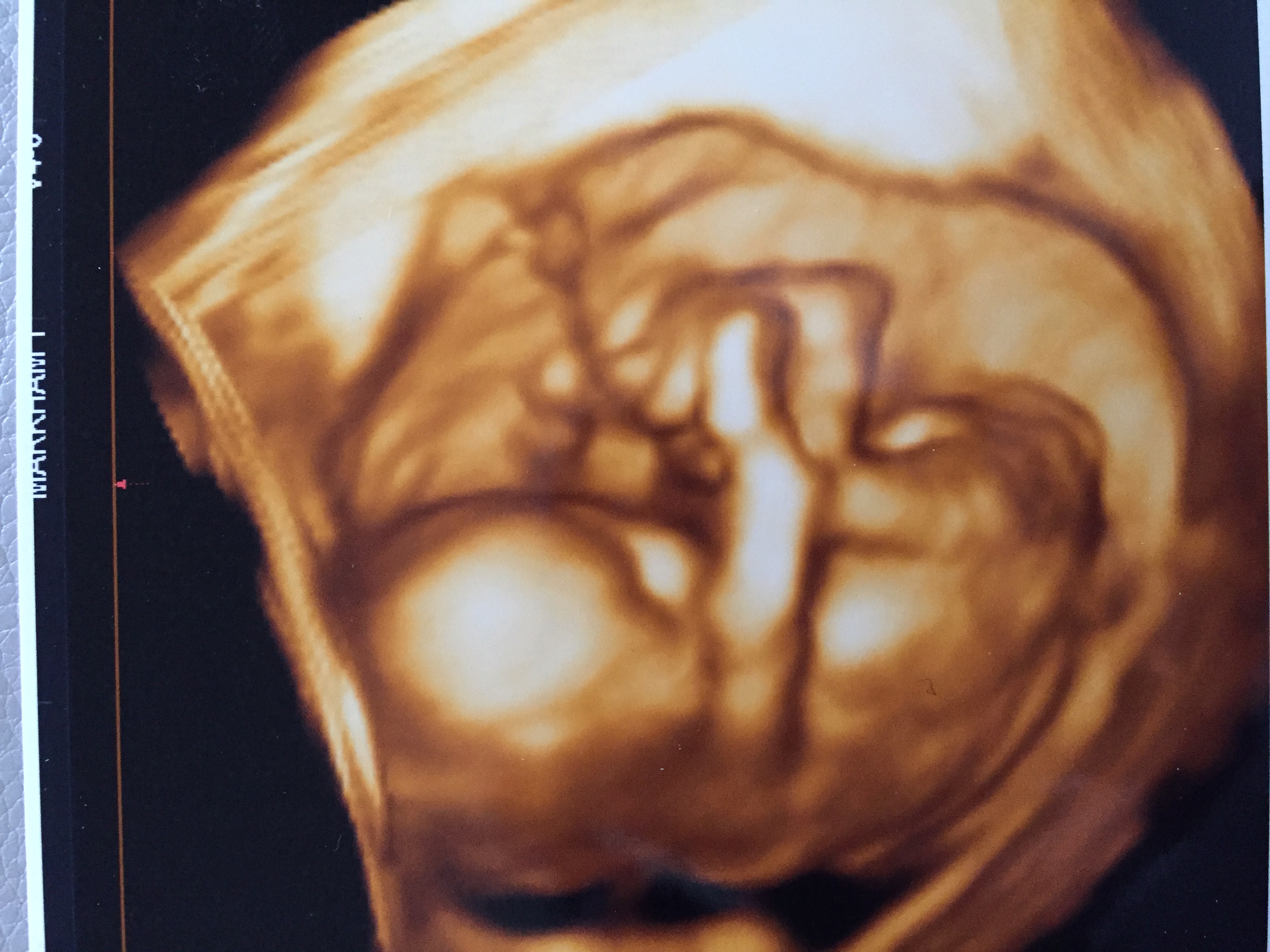16 week 3D ultrasound - boy or girl?! Help?!