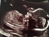 Girlswaylondon's Avatar Girlswaylondon's Avatar