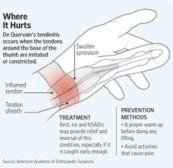 Wrist tendonitis steroid injection